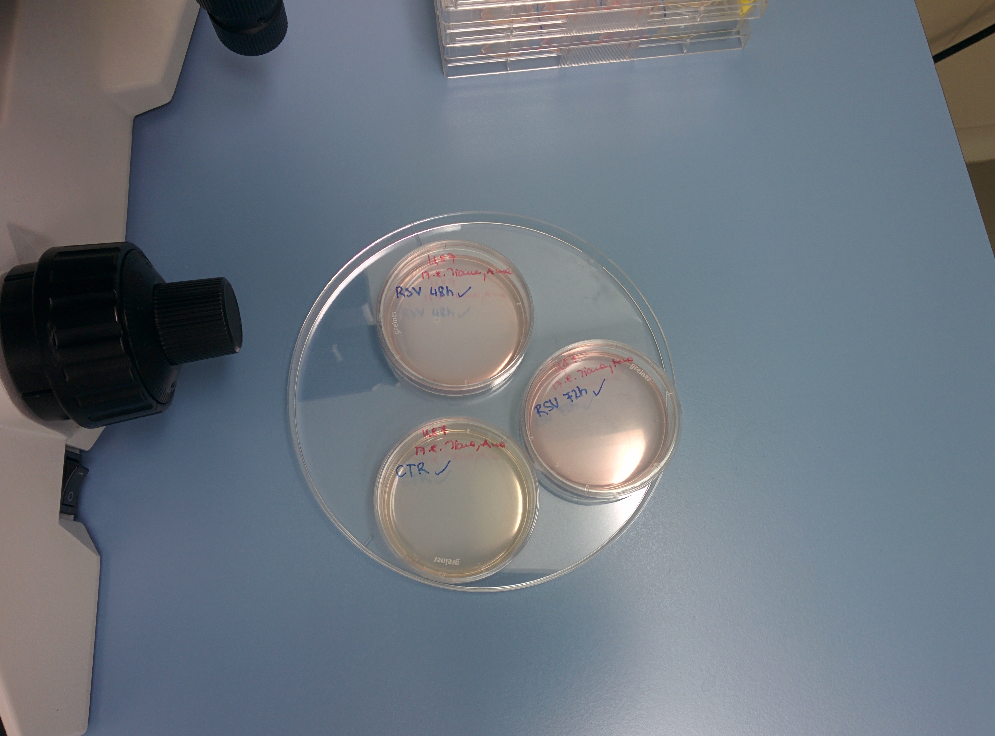 Picture 2: Three petri dishes with U87 cells